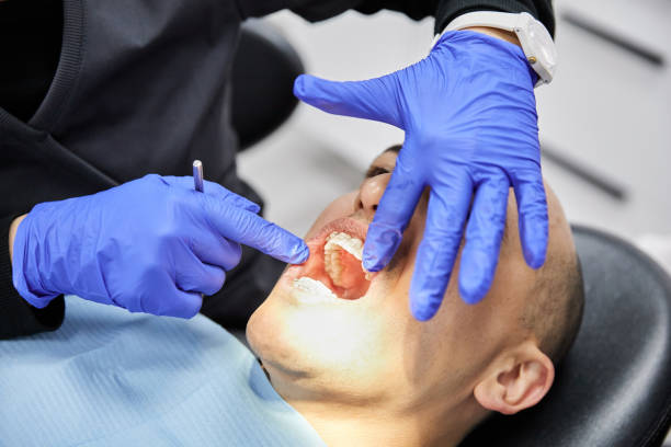 Best Emergency Wisdom Teeth Removal in Enid, OK